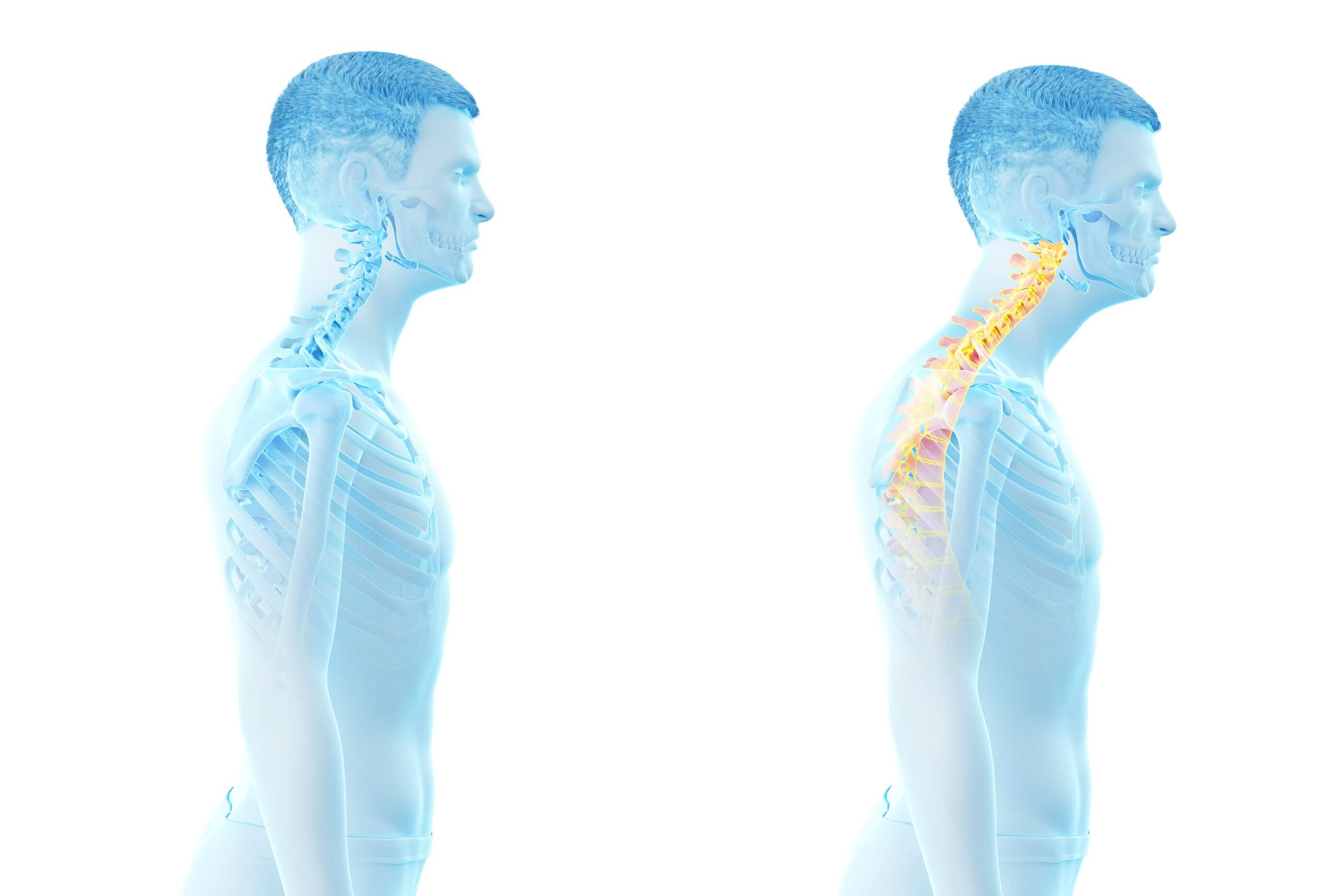 How to Correct Forward Head Posture Greater Austin Pain Center